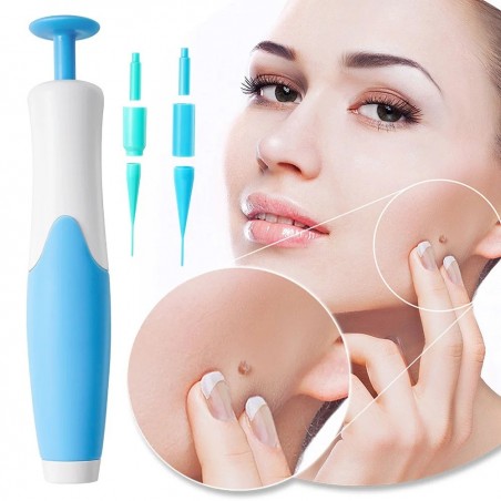 Skin Tag Remover Kit